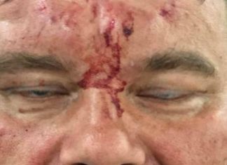 Jornalista polonês é agredido durante cobertura na Venezuela