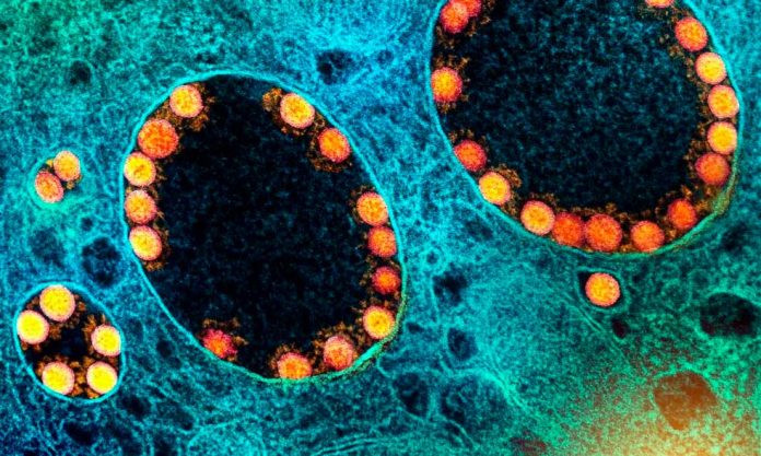 NIAD-NATIONAL-INSTITUTE-1 BQ.1: o que se sabe sobre variante da ômicron descoberta no Brasil — Foto: NIAD-NATIONAL INSTITUTE OF ALLERGY AND INFECTIOUS