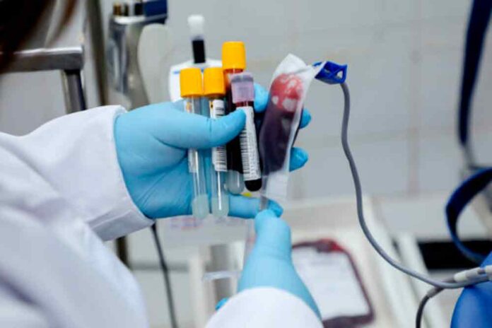 Doação-de-sangue-em-Rondônia Governo de Rondônia reforça campanhas de doação de sangue para manter os estoques em hemocentros e salvar vidas. Saiba mais!