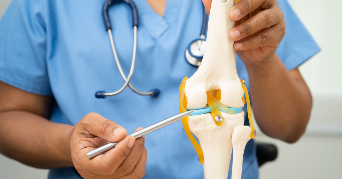 Ortopedista aponta para modelo anatômico de joelho, explicando regiões afetadas pela artrose