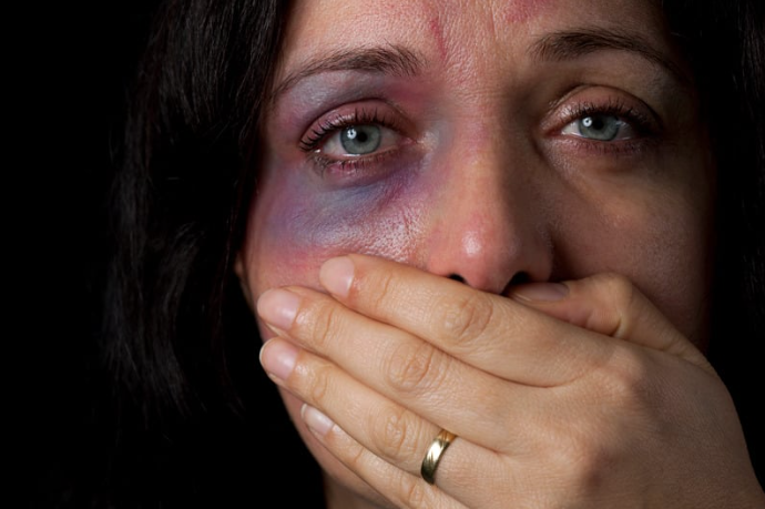 Mulher com rosto machucado cobrindo a boca em situação de violência doméstica.