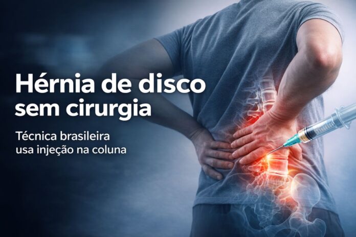 Hérnia de disco sem cirurgia com técnica brasileira Tratamento de hérnia de disco sem cirurgia com injeção aplicada na coluna